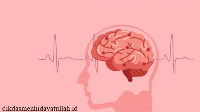 Mengenal Stroke Iskemik Akibat Sumbatan Pembuluh Darah Otak